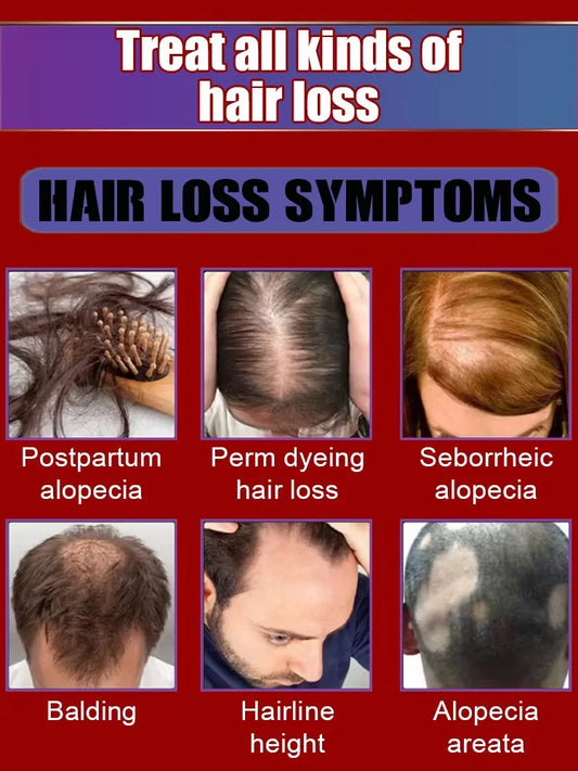 Everyone needs hair care,Save Your Hair