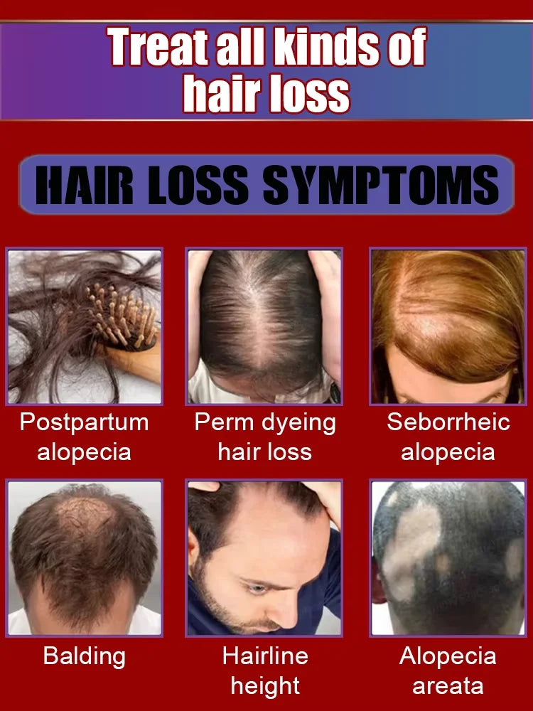 Everyone needs hair care,Save Your Hair