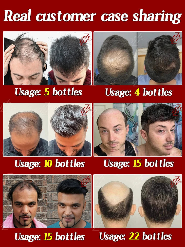 Everyone needs hair care,Save Your Hair