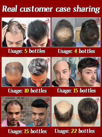 Everyone needs hair care,Save Your Hair