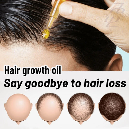 Everyone needs hair care,Save Your Hair